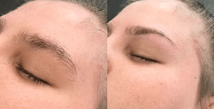 Eyebrow threading clearance